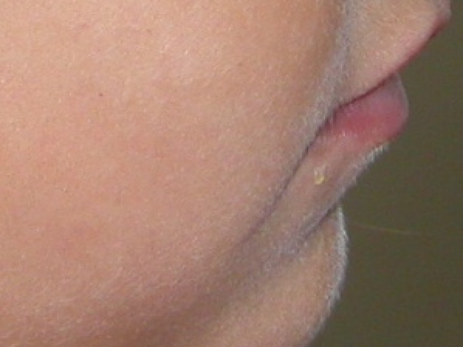 Ortodonzia Intercettiva