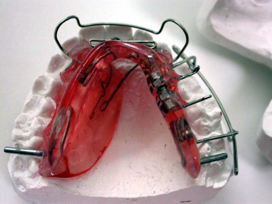 Deviazione mandibolare