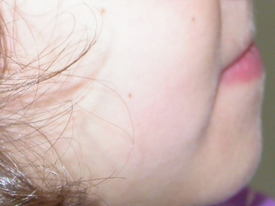 Ortodonzia Intercettiva